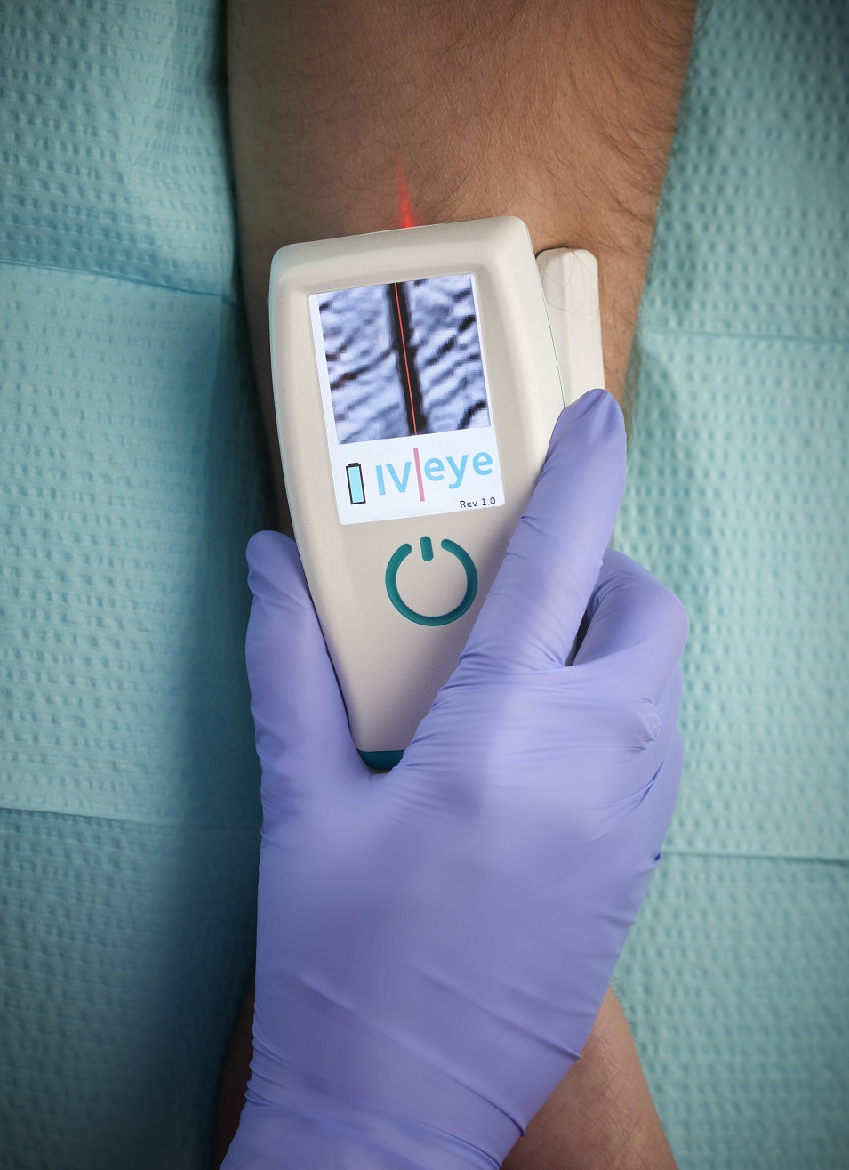 IV-eye device in clinical use